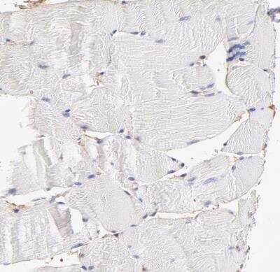 Immunohistochemistry-Paraffin: CD2AP Antibody [NBP1-90625] - Staining of human skeletal muscle shows no positivity in myocytes.