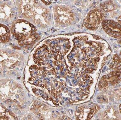 Immunohistochemistry-Paraffin: CD2AP Antibody [NBP1-90625] - Staining of human kidney shows strong membranous positivity in cells in glomeruli.