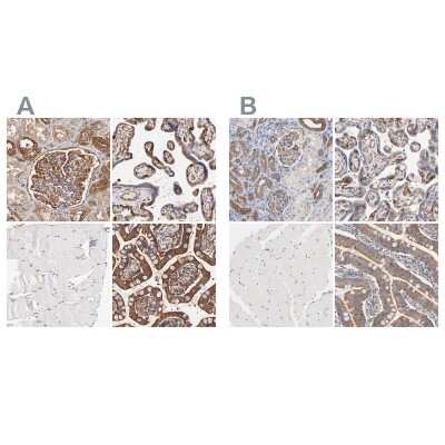 Immunohistochemistry-Paraffin: CD2AP Antibody [NBP1-90625] - Staining of human kidney, placenta, skeletal muscle and small intestine using Anti-CD2AP antibody NBP1-90625 (A) shows similar protein distribution across tissues to independent antibody NBP1-90626 (B).