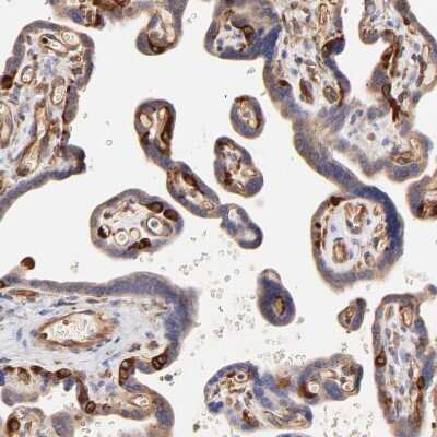 Immunohistochemistry-Paraffin: CD2AP Antibody [NBP1-90625] - Staining of human placenta shows strong cytoplasmic positivity in endothelial cells.