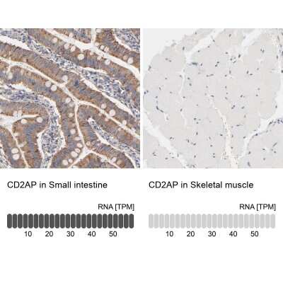 Immunohistochemistry-Paraffin: CD2AP Antibody [NBP1-90626] - Analysis in human small intestine and skeletal muscle tissues. Corresponding CD2AP RNA-seq data are presented for the same tissues.