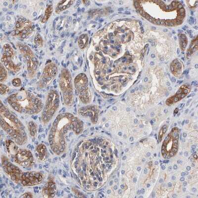 Immunohistochemistry-Paraffin: CD2AP Antibody [NBP1-90626] - Staining of human kidney shows moderate membranous positivity in cells in glomeruli.