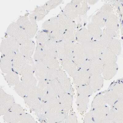 Immunohistochemistry-Paraffin: CD2AP Antibody [NBP1-90626] - Staining of human skeletal muscle shows no positivity in myocytes.