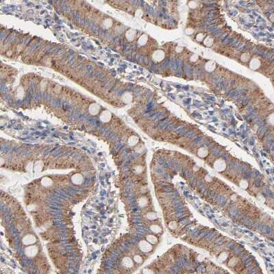 Immunohistochemistry-Paraffin: CD2AP Antibody [NBP1-90626] - Staining of human small intestine shows moderate granular positivity in cytoplasm in glandular cells.