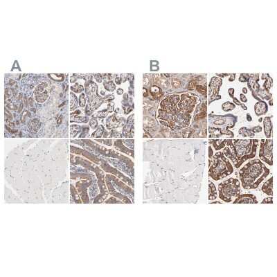 <b>Independent Antibodies Validation and Orthogonal Strategies Validation.</b>Immunohistochemistry-Paraffin: CD2AP Antibody [NBP1-90626] - Staining of human kidney, placenta, skeletal muscle and small intestine using Anti-CD2AP antibody NBP1-90626 (A) shows similar protein distribution across tissues to independent antibody NBP1-90625 (B).