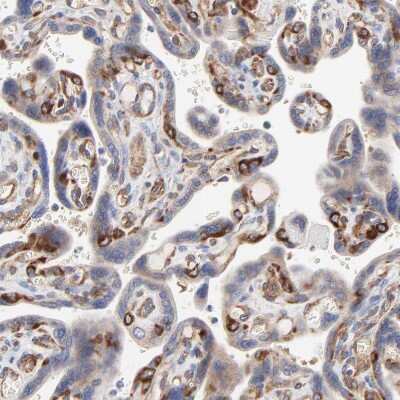 Immunohistochemistry-Paraffin: CD2AP Antibody [NBP1-90626] - Staining of human placenta shows strong cytoplasmic positivity in endothelial cells.