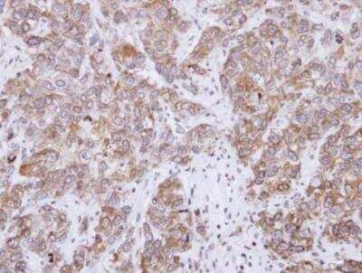 Immunohistochemistry-Paraffin: CD2AP Antibody [NBP2-53098] - FaDu xenograft, using CD2-associated protein antibody at 1:500 dilution. Antigen Retrieval: Trilogy™ (EDTA based, pH 8.0) buffer, 15min.