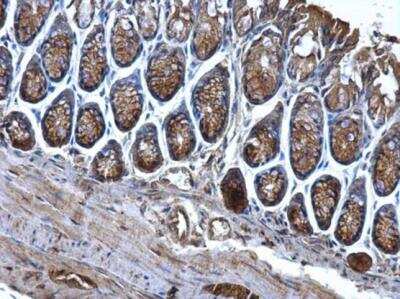 Immunohistochemistry-Paraffin: CD2AP Antibody [NBP2-53098] - Mouse colon. CD2AP antibody dilution: 1:500. Antigen Retrieval: Trilogy™ (EDTA based, pH 8.0) buffer, 15min.