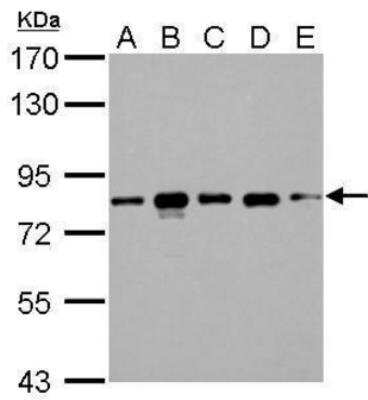 Western Blot: CD2AP Antibody [NBP2-53098] - CD2AP antibody detects CD2AP protein by Western blot analysis.A. 30 ug 293T whole cell lysate/extract B. 30 ug A431 whole cell lysate/extract C. 30 ug HeLa whole cell lysate/extract D. 30 ug HepG2 whole cell lysate/extract E. 30 ug A375 whole cell lysate/extract 7.5 % SDS-PAGE CD2AP antibody dilution: 1:1000