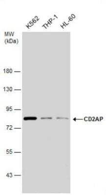 Western Blot: CD2AP Antibody [NBP2-53098] - Various whole cell extracts (30 ug) were separated by 7.5% SDS-PAGE, and the membranes were blotted with CD2AP antibody diluted at 1:1000. HRP-conjugated anti-rabbit IgG antibody was used to detect the primary antibody.