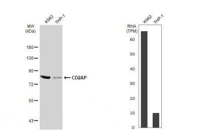 Western Blot: CD2AP Antibody [NBP2-53098] - Various whole cell extracts (30 ug) were separated by 7.5% SDS-PAGE, and the membrane was blotted with CD2AP antibody diluted at 1:1000. HRP-conjugated anti-rabbit IgG antibody was used to detect the primary antibody.