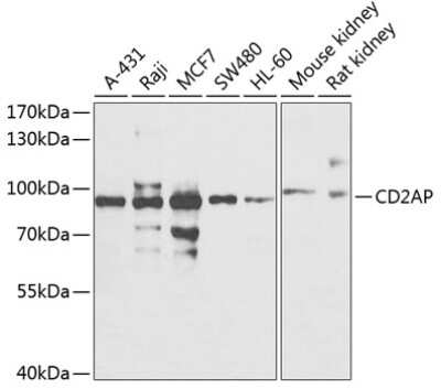 Western Blot: CD2AP Antibody [NBP2-92517] - Analysis of extracts of various cell lines, using CD2AP .Exposure time: 60s.