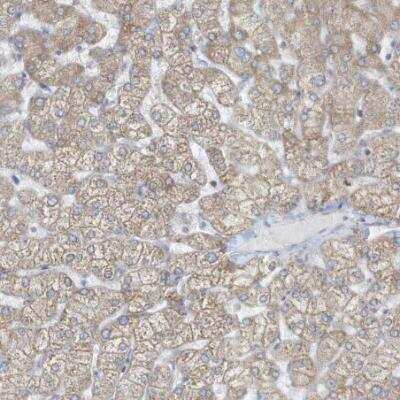 Immunohistochemistry-Paraffin: CD2F-10/SLAMF9 Antibody [NBP1-84593] - Staining of human liver shows weak membranous positivity in hepatocytes.
