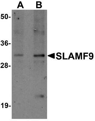 Western Blot: CD2F-10/SLAMF9 Antibody [NBP1-76534] - Mouse kidney tissue lysate with SLAMF9 antibody at (A) 1 and (B) 2 ug/mL.