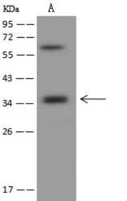 Western Blot: CD2F-10/SLAMF9 Antibody [NBP3-12603] - Lane A: U-251 MG Whole Cell LysateLysates/proteins at 30 ug per lane.SecondaryGoat Anti-Rabbit IgG (H+L)/HRP at 1/10000 dilution.Developed using the ECL technique.Performed under reducing conditions.Predicted band size:32 kDaObserved band size:35 kDa(We are unsure as to the identity of these extra bands.)