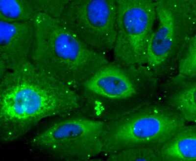 Immunocytochemistry/Immunofluorescence: CD3 delta Antibody (JJ08-97) [NBP2-67882] - Staining CD3D in A431 cells (green). The nuclear counter stain is DAPI (blue). Cells were fixed in paraformaldehyde, permeabilised with 0.25% Triton X100/PBS.