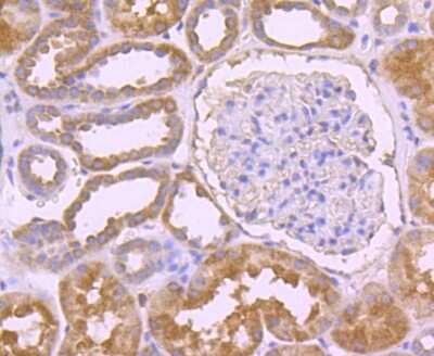 Immunohistochemistry-Paraffin: CD3 delta Antibody (JJ08-97) [NBP2-67882] - Analysis of paraffin-embedded human kidney tissue using anti-CD3D antibody. Counter stained with hematoxylin.