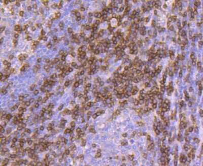Immunohistochemistry-Paraffin: CD3 delta Antibody (JJ08-97) [NBP2-67882] - Analysis of paraffin-embedded human tonsil tissue using anti-CD3D antibody. Counter stained with hematoxylin.