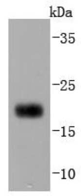 Western Blot: CD3 delta Antibody (JJ08-97) [NBP2-67882] - Analysis of CD3D on Jurkat cells lysates using anti-CD3D antibody at 1/1,000 dilution.