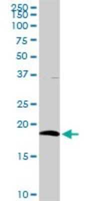 Western Blot: CD3 delta Antibody [H00000915-D01P] - Analysis of CD3D expression in mouse kidney.