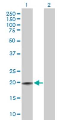 Western Blot: CD3 delta Antibody [H00000915-D01P] - Analysis of CD3D expression in transfected 293T cell line by CD3D polyclonal antibody.Lane 1: CD3D transfected lysate(18.90 KDa).Lane 2: Non-transfected lysate.