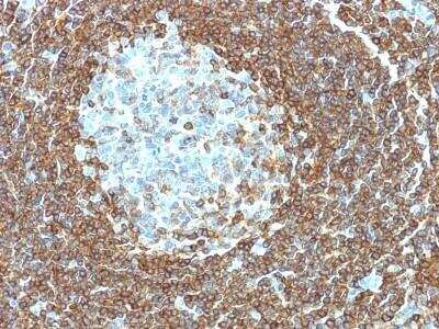 Immunohistochemistry-Paraffin: CD3 epsilon Antibody (C3e/1308) [DyLight 594] [NBP2-47840DL594] - Formalin-fixed, paraffin-embedded human Tonsil stained with CD3 epsilon Monoclonal Antibody (C3e/1308).