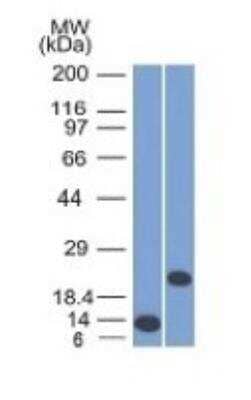 Western Blot: CD3 epsilon Antibody (C3e/1308) [DyLight 594] [NBP2-47840DL594] - Western Blot of recombinant CD3e and Jurkat Cell Lysate using CD3e Monoclonal Antibody (C3e/1308)