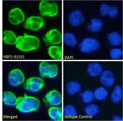 Immunocytochemistry/Immunofluorescence: CD3 epsilon Antibody (OKT-3 (muromonab)) [NBP2-81031] - Immunofluorescence staining of fixed Molt4 cells with CD3 epsilon Antibody (OKT-3 (muromonab)) [NBP2-81031]. Immunofluorescence analysis of paraformaldehyde fixed Molt4 cells on Shi-fix coverslips, permeabilized with 0.15% Triton and stained with the chimeric rabbit IgG version of OKT-3 [NBP2-81031] at 10 ug/ml for 1h followed by Alexa Fluor 488 secondary antibody (1 ug/ml), showing membrane staining. The nuclear stain is DAPI (blue). Panels show from left-right, top-bottom NBP2-81031, DAPI, merged channels and an isotype control. The isotype control was stained with an anti-Fluorescein antibody followed by Alexa Fluor 488 secondary antibody.