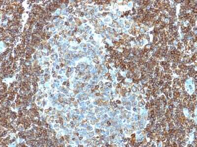 Immunohistochemistry-Paraffin: CD3 epsilon Antibody (PC3/188A) - Azide and BSA Free [NBP2-54405] - Formalin-fixed, paraffin-embedded human Tonsil stained with CD3 epsilon Monoclonal Antibody (PC3/188A).