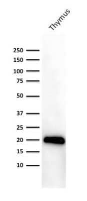 Western Blot: CD3 epsilon Antibody (PC3/188A) - Azide and BSA Free [NBP2-54405] - Western Blot Analysis of human Thymus lysate using Purified CD3 epsilon Antibody (PC3/188A).