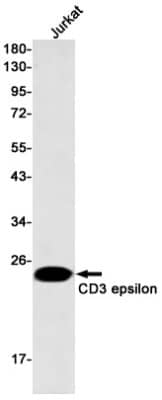 Western Blot: CD3 epsilon Antibody (S02-1B5) [NBP3-20034] - Western blot detection of CD3 epsilon in Jurkat cell lysates using NBP3-20034 (1:500 diluted). Predicted band size: 23kDa. Observed band size: 23kDa.