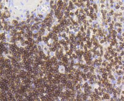 Immunohistochemistry-Paraffin: CD3 epsilon Antibody (SY0239) [NBP2-67428] - Analysis of paraffin-embedded human spleen tissue using anti-CD3 epsilon antibody. Counter stained with hematoxylin.