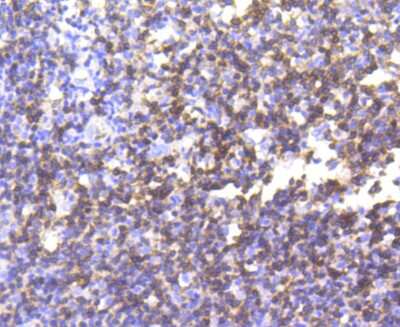 Immunohistochemistry-Paraffin: CD3 epsilon Antibody (SY0239) [NBP2-67428] - Analysis of paraffin-embedded human tonsil tissue using anti-CD3 epsilon antibody. Counter stained with hematoxylin.
