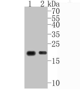 Western Blot: CD3 epsilon Antibody (SY0239) [NBP2-67428] - Analysis of CD3 epsilon on different lysates. Proteins were transferred to a PVDF membrane and blocked with 5% BSA in PBS for 1 hour at room temperature. The primary antibody (1/500) was used in 5% BSA at room temperature for 2 hours. Goat Anti-Rabbit IgG - HRP Secondary Antibody at 1:5,000 dilution was used for 1 hour at room temperature. Positive control: Lane 1: human thymus tissue lysateLane 2: Jurkat cell lysate