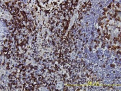 Immunohistochemistry-Paraffin: CD3 zeta Antibody (4A12-F6) [H00000919-M01] - Analysis of monoclonal antibody to CD3Z on formalin-fixed paraffin-embedded human lymph node tissue. Antibody concentration 5 ug/ml.
