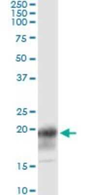 Immunoprecipitation: CD3 zeta Antibody (4A12-F6) [H00000919-M01] - Analysis of CD247 transfected lysate using anti-CD247 monoclonal antibody and Protein A Magnetic Bead, and immunoblotted with CD247 MaxPab rabbit polyclonal antibody.