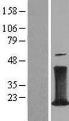 Western Blot: CD3 zeta Overexpression Lysate (Adult Normal) [NBL1-08925] Left-Empty vector transfected control cell lysate (HEK293 cell lysate); Right -Over-expression Lysate for CD3 zeta.