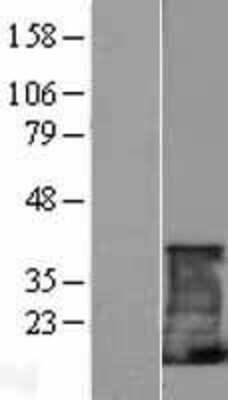 Western Blot: CD3 zeta Overexpression Lysate (Adult Normal) [NBP2-10689] Left-Empty vector transfected control cell lysate (HEK293 cell lysate); Right -Over-expression Lysate for CD3 zeta.