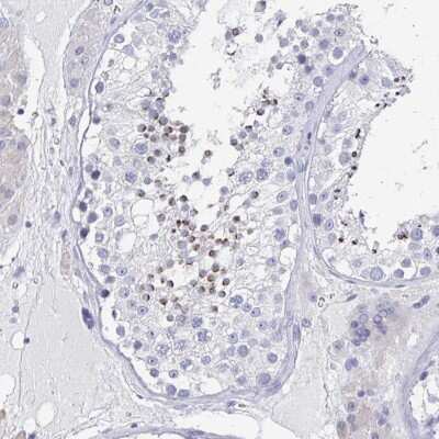 Immunohistochemistry: CD30/TNFRSF8 Antibody [NBP2-38201] - Staining of human testis shows strong cytoplasmic positivity in a subset of cells in seminiferus ducts.