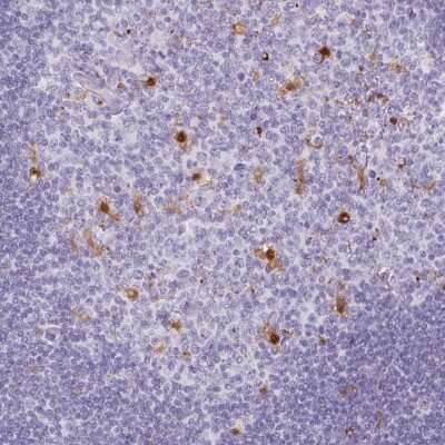 Immunohistochemistry: CD30/TNFRSF8 Antibody [NBP2-38202] - Staining of human tonsil shows leukocyte positivity in germinal center.