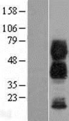 Western Blot CD300a/LMIR1 Overexpression Lysate