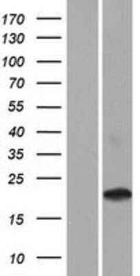 Western Blot: CD300LD Overexpression Lysate (Adult Normal) [NBP2-09404] Left-Empty vector transfected control cell lysate (HEK293 cell lysate); Right -Over-expression Lysate for CD300LD.
