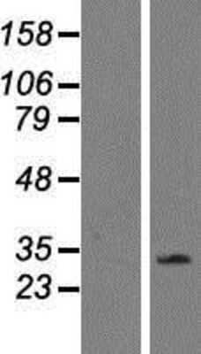 Western Blot: CD300LF Overexpression Lysate (Adult Normal) [NBP2-05598] Left-Empty vector transfected control cell lysate (HEK293 cell lysate); Right -Over-expression Lysate for CD300LF.