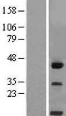 Western Blot: CD300LG Overexpression Lysate (Adult Normal) [NBL1-08933] Left-Empty vector transfected control cell lysate (HEK293 cell lysate); Right -Over-expression Lysate for CD300LG.