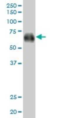 Western Blot: CD300a/LMIR1 Antibody [H00011314-B01P] - Analysis of CD300A expression in human spleen.
