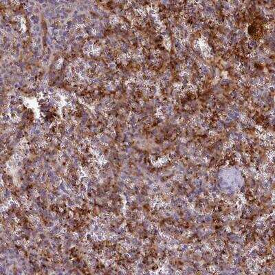 Immunohistochemistry: CD300f/LMIR3/CD300LF Antibody [NBP2-14463] - Staining of human spleen shows strong cytoplasmic positivity in cells in red pulp.