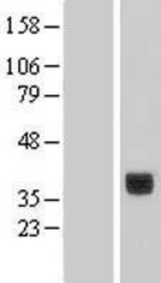 Western Blot: CD301 Overexpression Lysate (Adult Normal) [NBL1-09254] Left-Empty vector transfected control cell lysate (HEK293 cell lysate); Right -Over-expression Lysate for CD301.