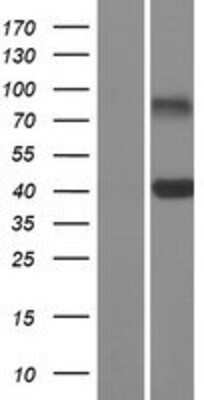 Western Blot: CD301 Overexpression Lysate (Adult Normal) [NBP2-11302] Left-Empty vector transfected control cell lysate (HEK293 cell lysate); Right -Over-expression Lysate for CD301.