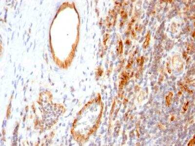 Immunohistochemistry-Paraffin: CD31/PECAM-1 Antibody (1A10) - IHC-Prediluted [NBP2-48329] - Formalin-fixed, paraffin-embedded human Tonsil.