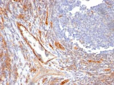 Immunohistochemistry-Paraffin: CD31/PECAM-1 Antibody (C31.10) [NBP2-44340] - Human Tonsil stained with CD31/PECAM-1 Antibody (C31.10).